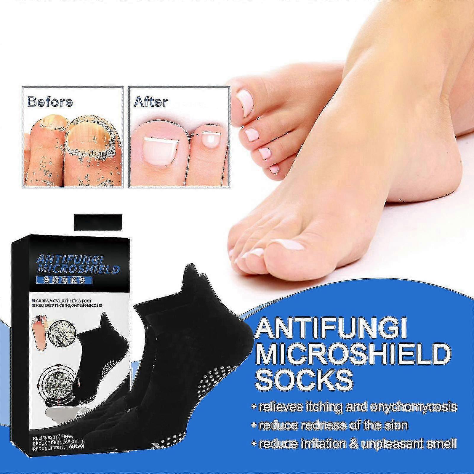 Antifungal Mikrokapsüller Hijyenik Çoraplar, Doğal Anti-fungal ve Anti-bakteriyel Ajanlar İçerir, Serin ve Kuru Kalın