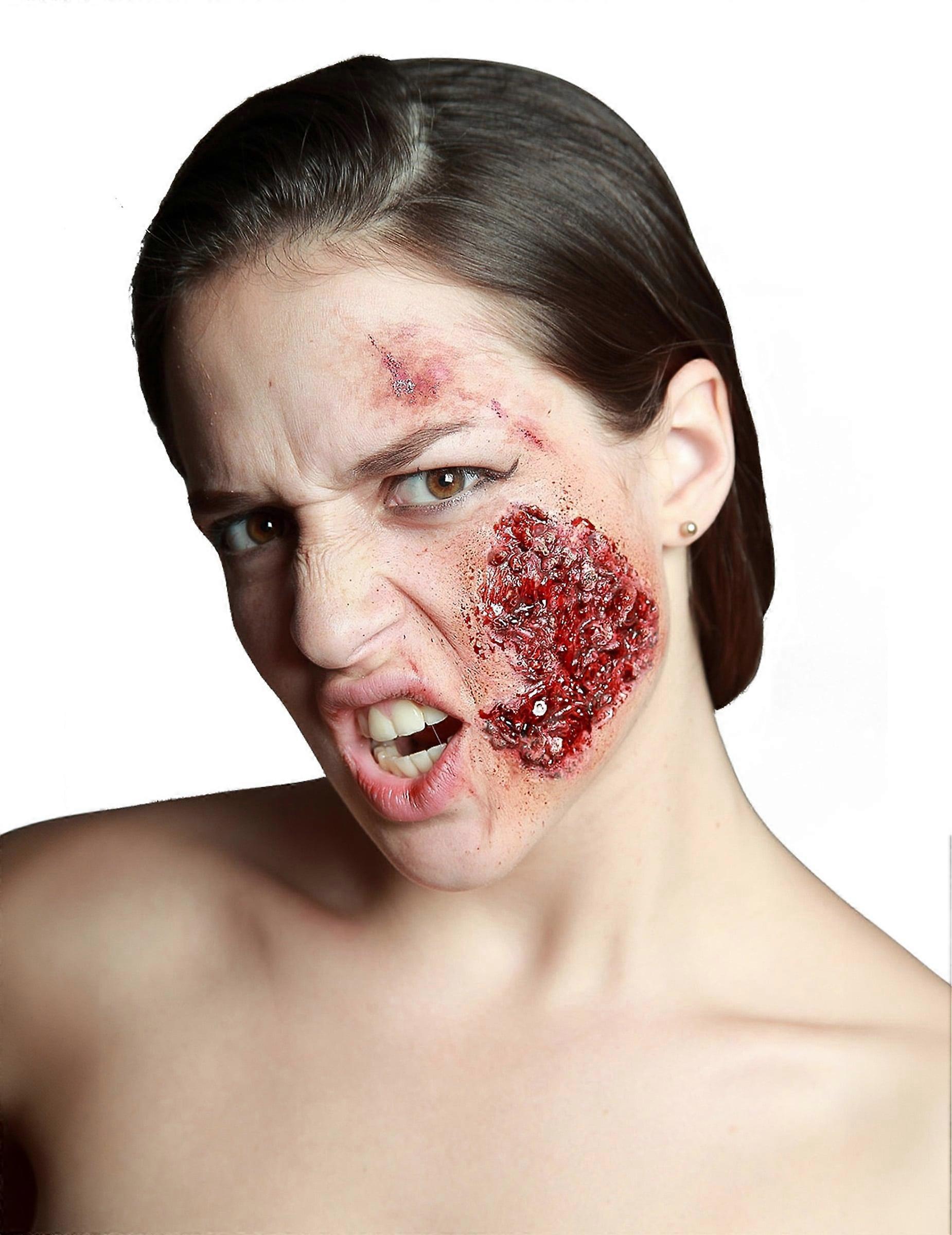 Infected false cheek