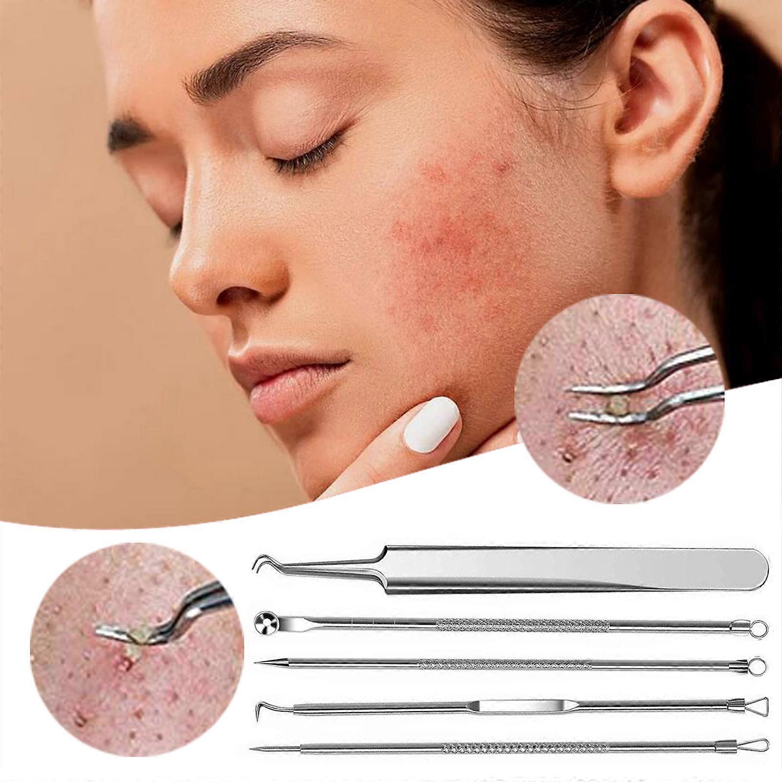 Blackhead Extractor Tool Blackhead Remover Tweezers Box Set 5 PCS FLYE2958