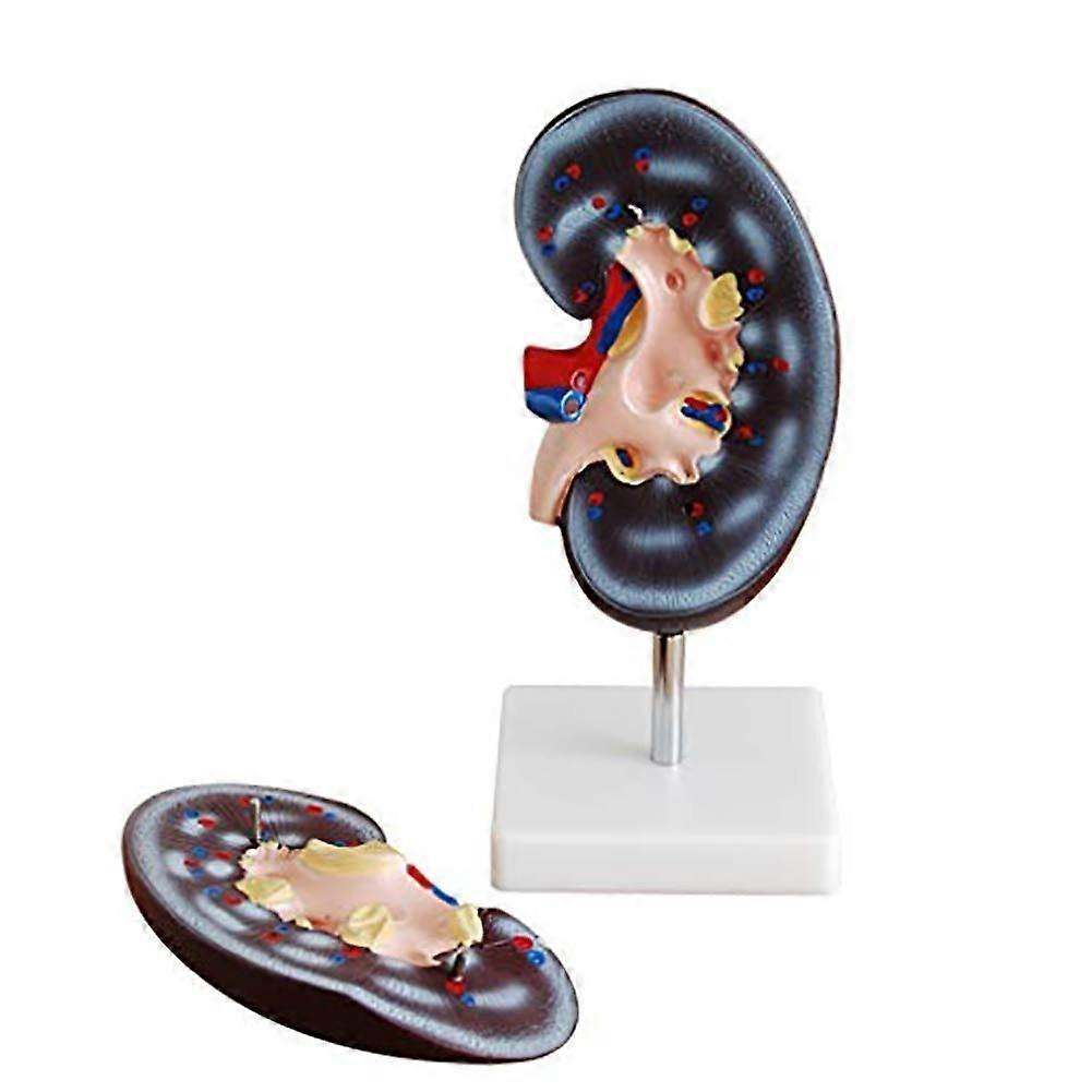 Anatomical Model - Large Human Kidney Model, 2-Part Educational Tool for School, Detailed Size for Organs and Intestines