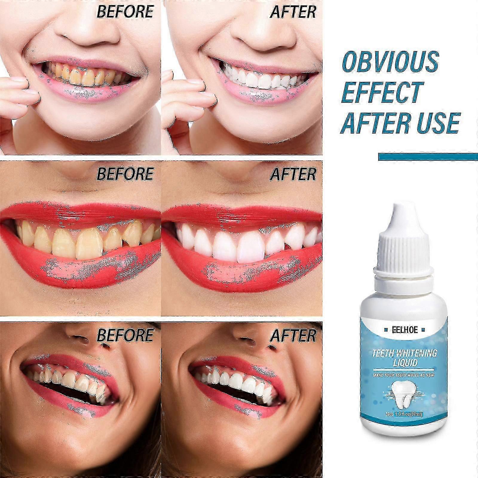 ウナギ歯ホワイトニング液体歯液体歯ブラック歯煙歯フレッシュブレスブライトニング