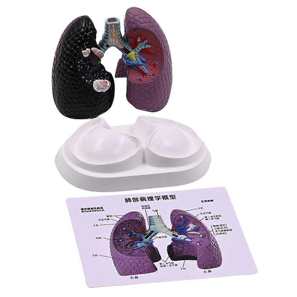 Pathological Lung Anatomy Model Human Anatomical Lung Model Teaching Tool