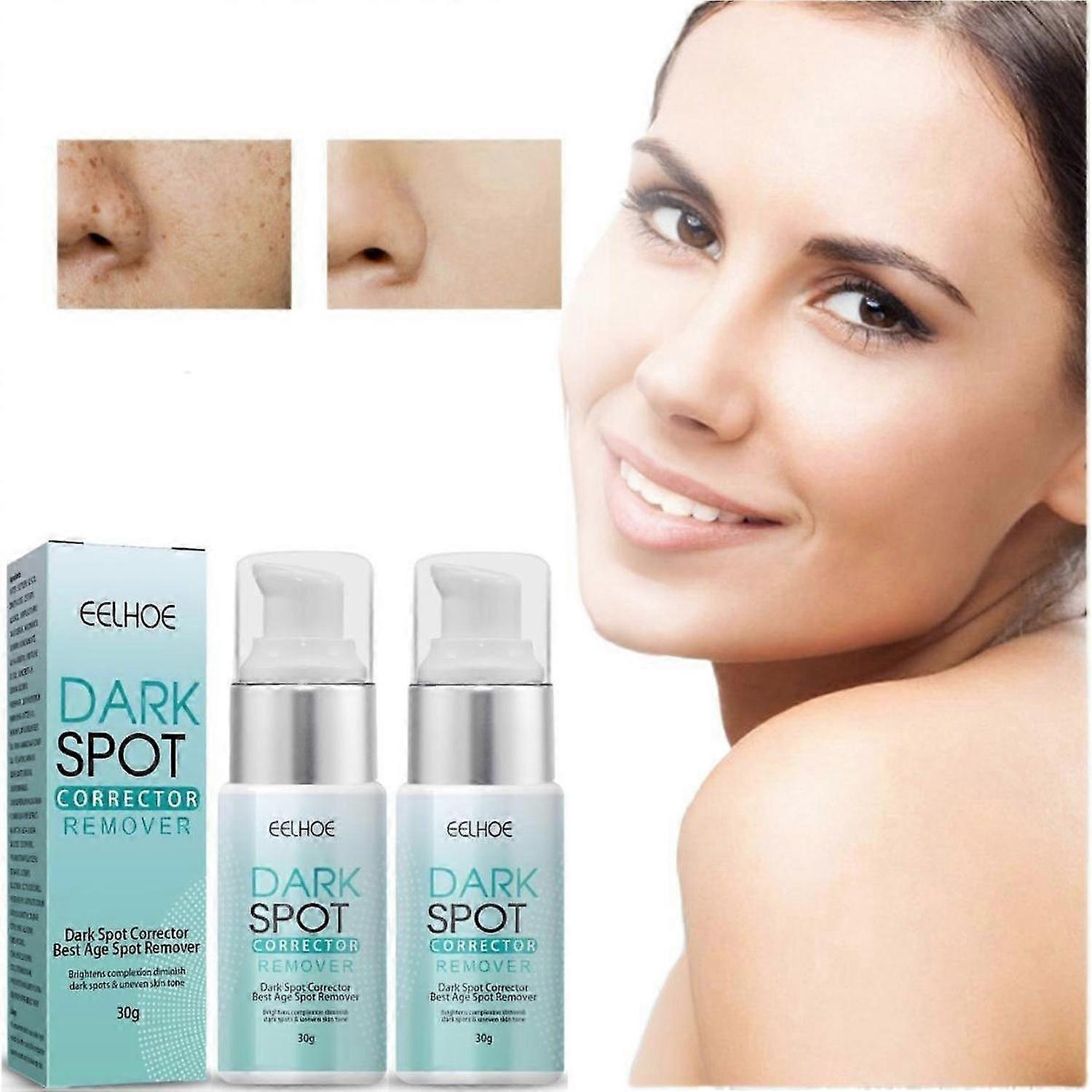 2 stks 2023 NIEUW Donkere Vlek Corrector Remover Gezicht Whitenning Anti-rimpel Verhelderende Crème