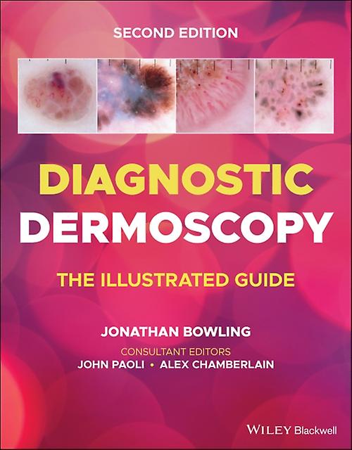 Diagnostic Dermoscopy Paperback