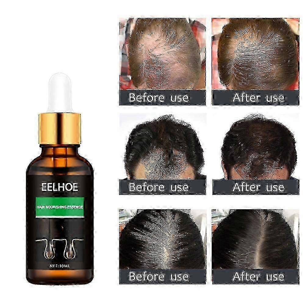 うなぎの乾燥縮れた髪の修復美容液