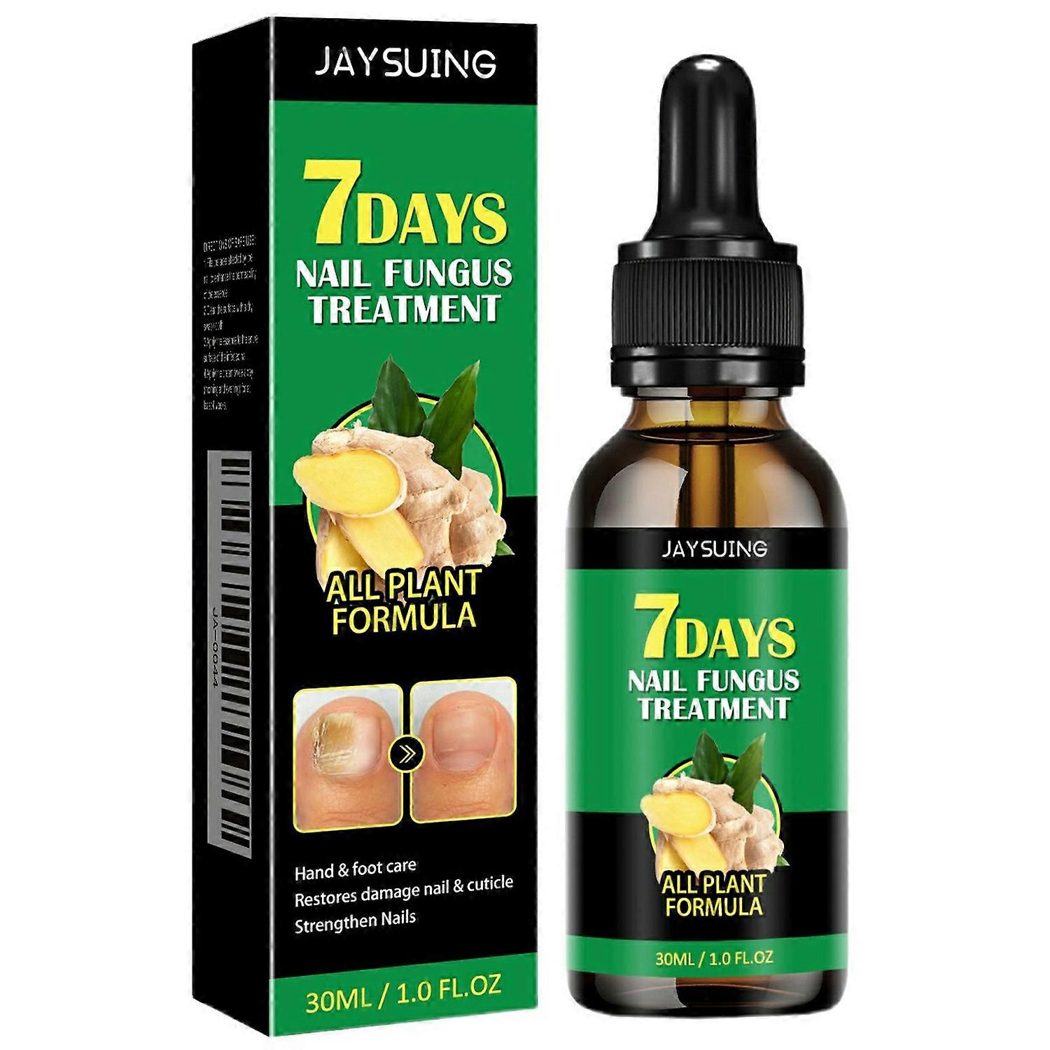 JAYSUING 30 مل مستخلص الزنجبيل علاج فطر الأظافر سائل مغذي لأظافر اليد والقدم ، zjxhy809cy