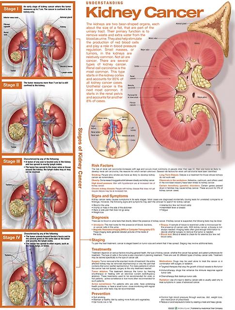 Understanding Kidney Cancer Anatomical Chart Wallchart Book