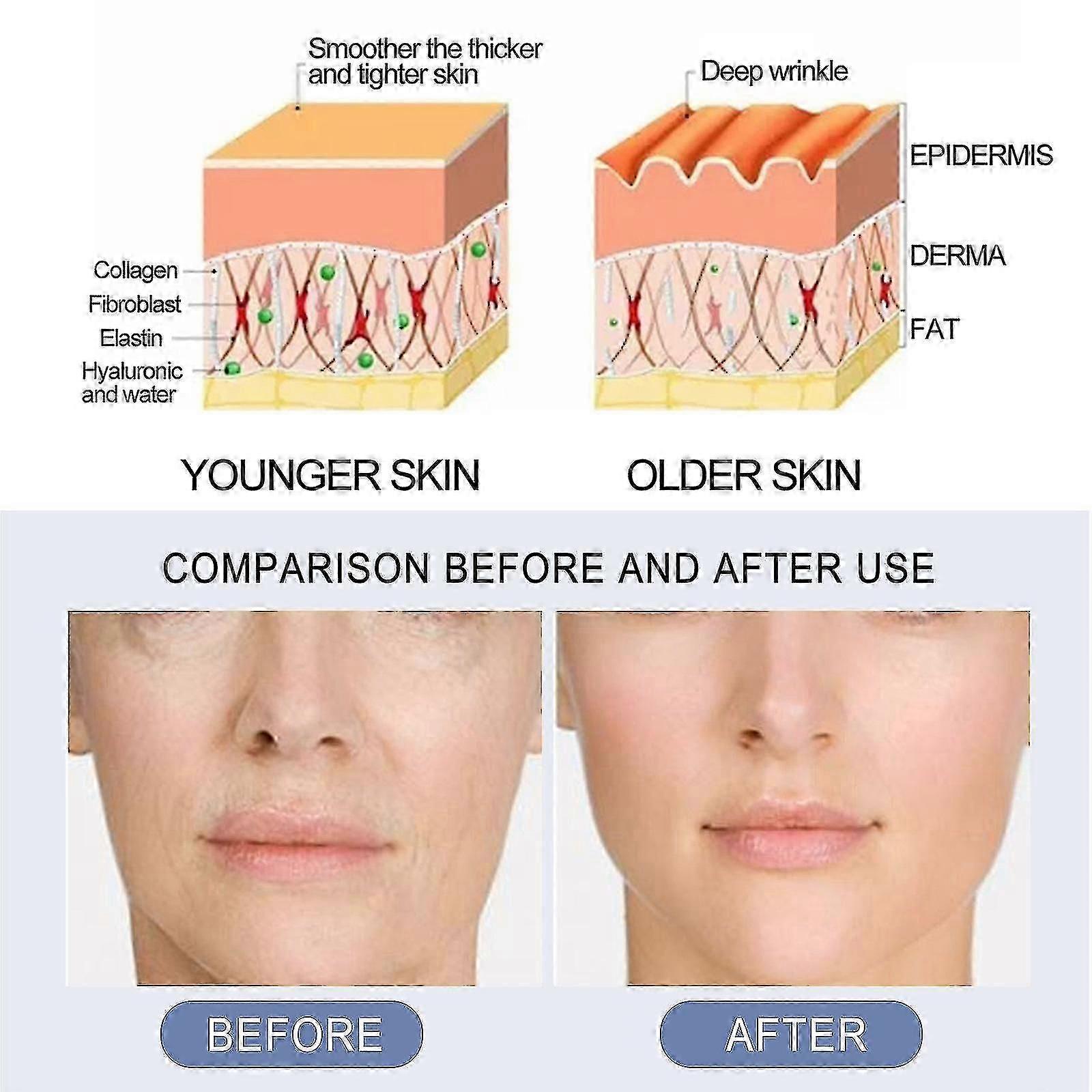 コラーゲンアンチリンクルセラム若返りと保湿マスクエッセンスは、しわを修復、若返らせ、引き締め、改善します