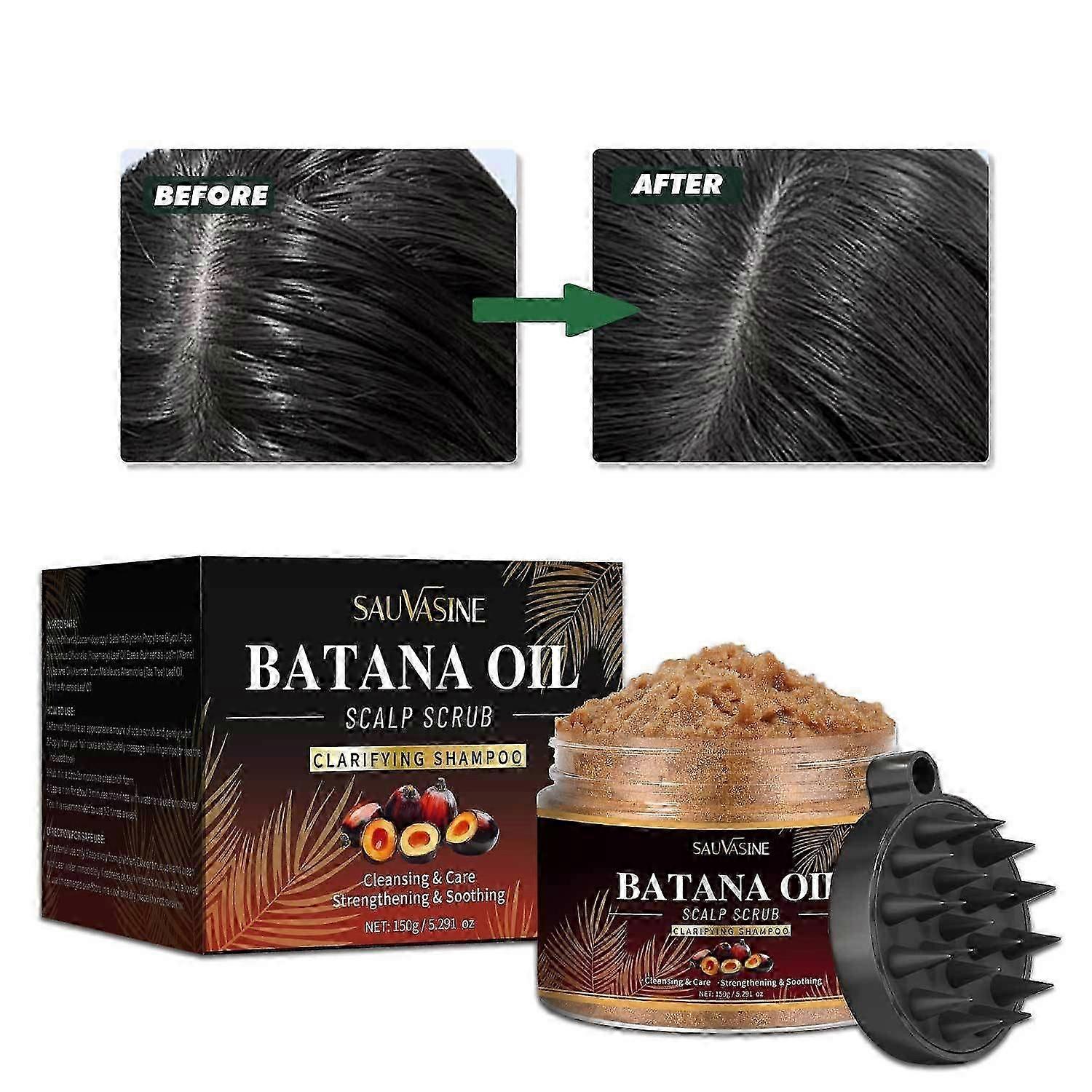Batana Oil Scalp Scrub for Thinning Hair, 2-in-1 Shampoo Exfoliating Scalp Scrub with Scalp Massager for Hair Growth, Scalp Treatment, Itchy Scalp Rel