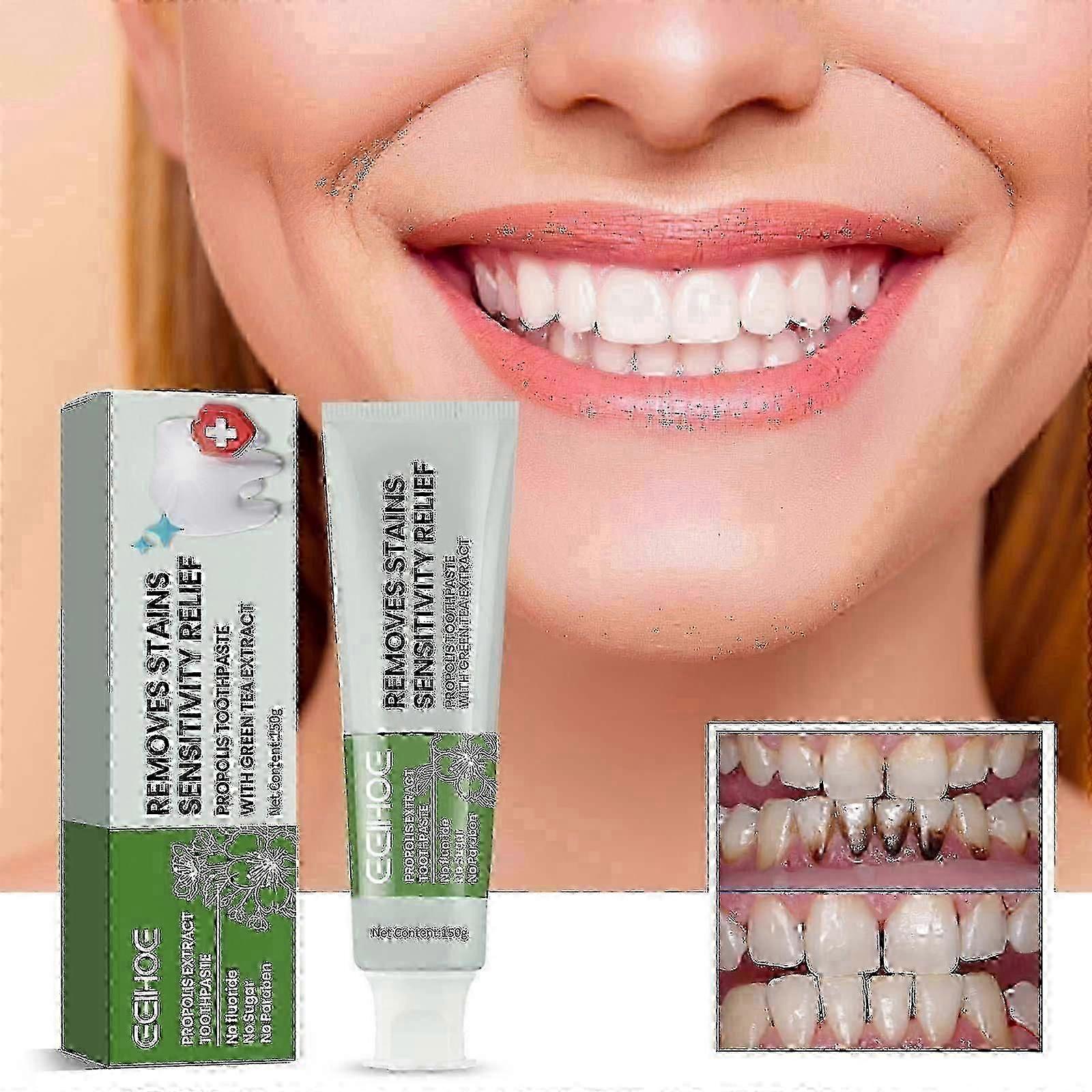 Propolis Toothpaste, Clean Stains Fresh Breath Tooth Whitening Toothpaste