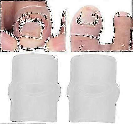 Silicone ingrown nail correction tool, elastic patch arc correction patch, paronychia Pa