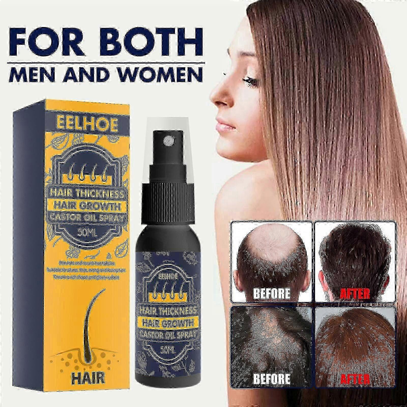 من ترطيب بصيلات الشعر زيت الخروع نمو الشعر ترطيب الشعر المضادة للسقوط Nutr