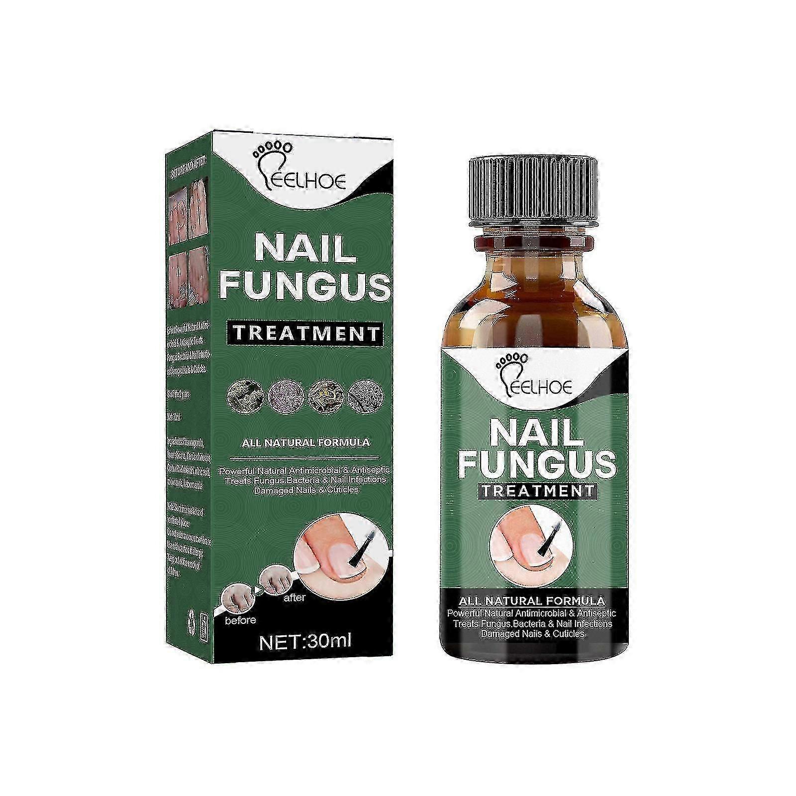 Solution de traitement des champignons des ongles 30ml
