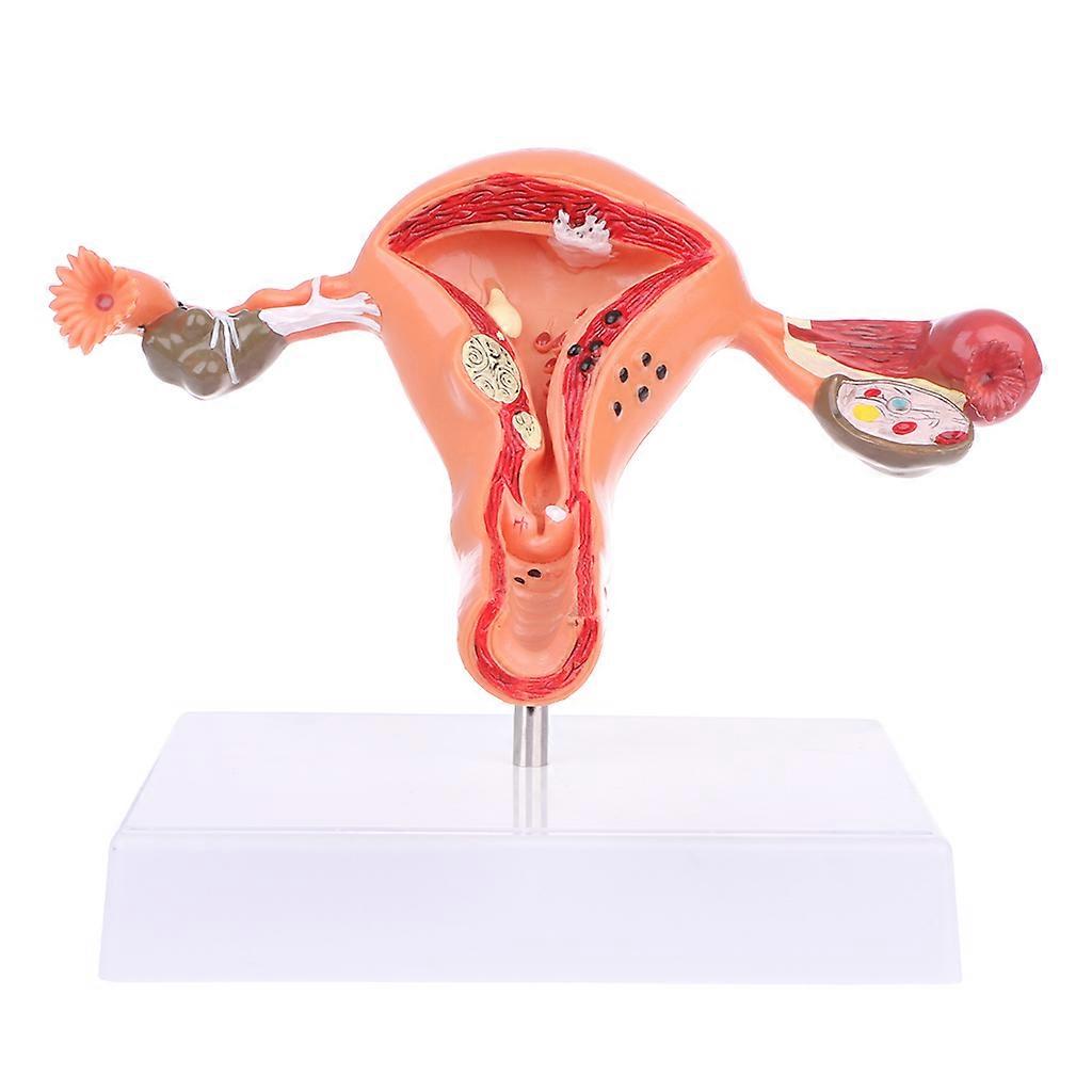 Pathological Uterus Ovary Anatomical Model Anatomy for Cross Section Study Tool Red