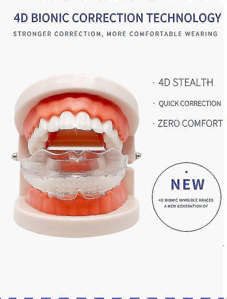 Ορθοδοντικός συγκρατητής, 3 στάδια που χρησιμοποιούν, πολυ λειτουργικά αόρατα σιδεράκια