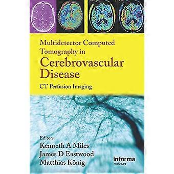 Multidetector Computed Tomography in Cerebrovascular Disease CT Perfusion Imaging