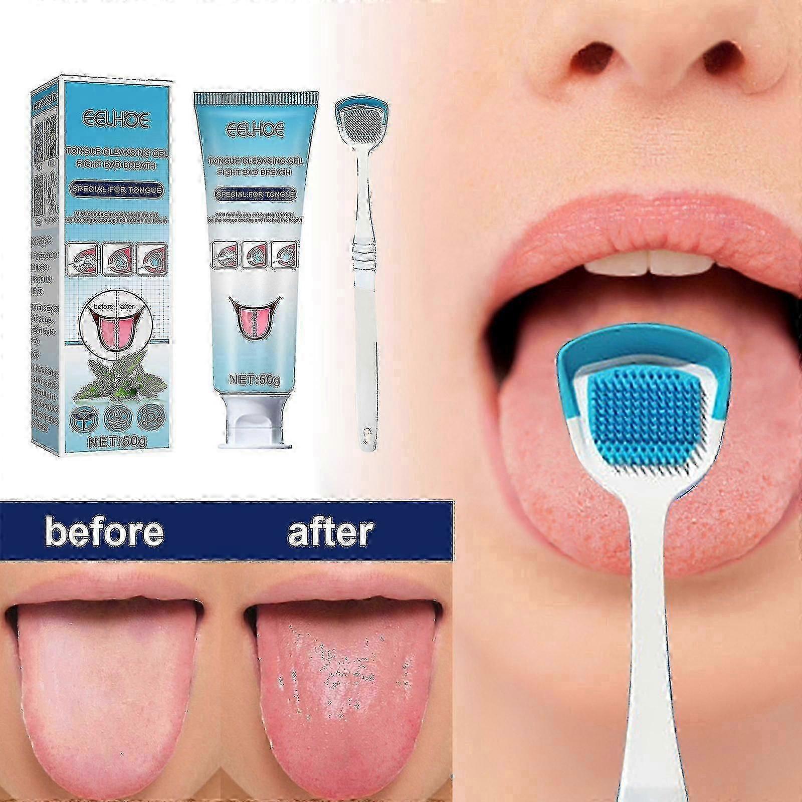 Enlève la mauvaise haleine, nettoie la fourrure de la langue, change le grattoir de langue malodorant, le passe-dents de soins bucco-dentaires