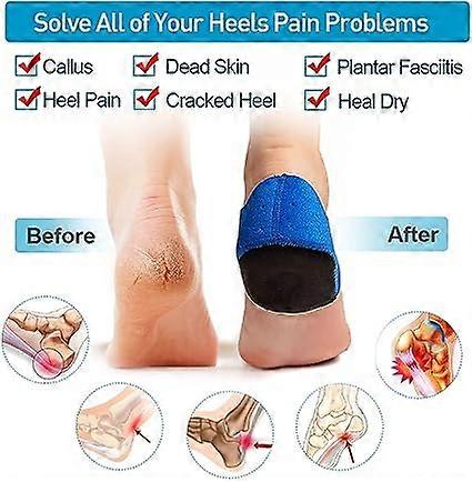 Heel Sleeves, 2PCS Breathable Heel Cushion, Heel Support for Plantar Fasciitis, Heel Protector Pads for Bone Spur, Heel Spur Pain Relief and Cracked H