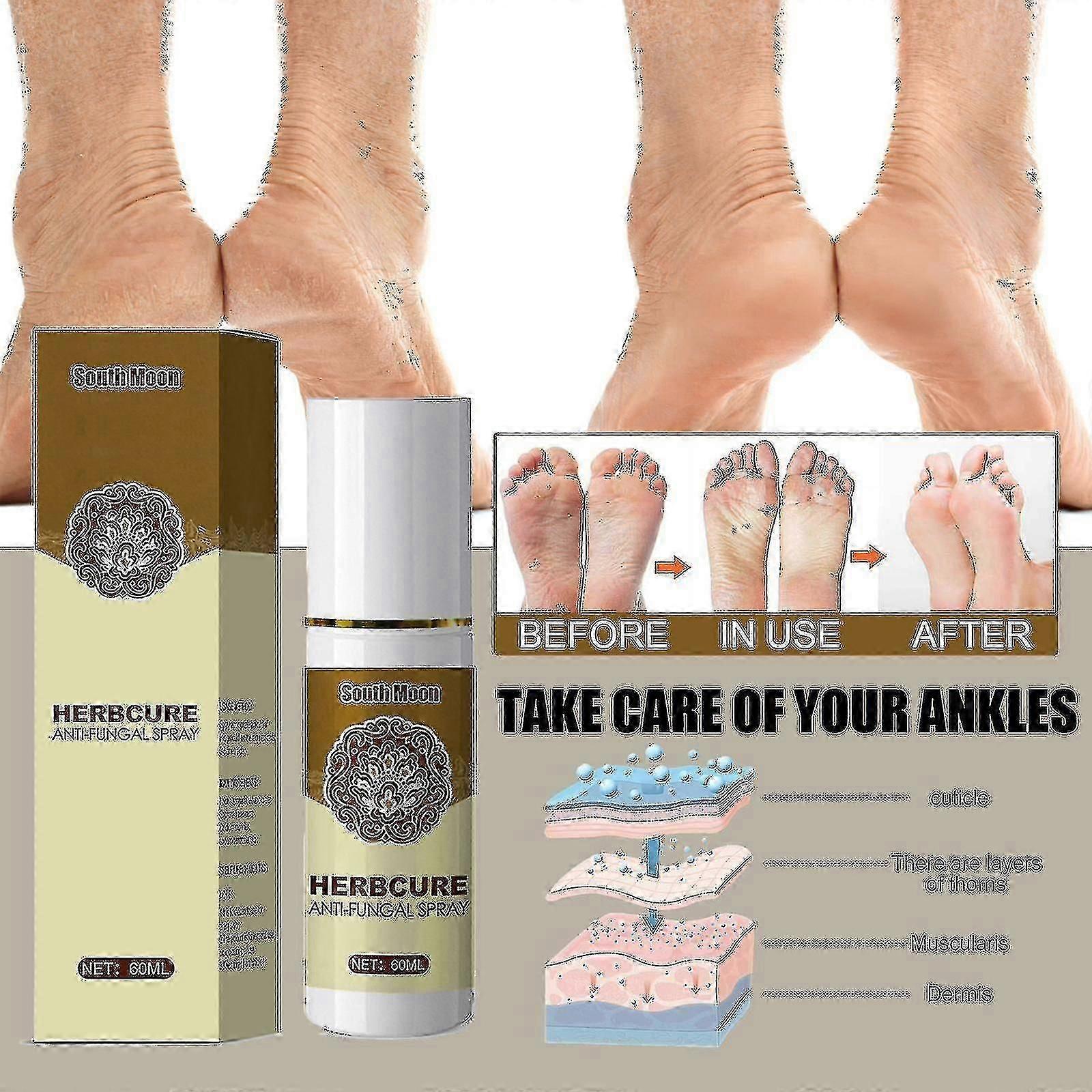 South Moon צמחי מרפא כף הרגל ספריי בוטני נגד גירוד ספריי כף הרגל זיעה כף הרגל ספריי לטיפול בריח כף הרגל ספריי