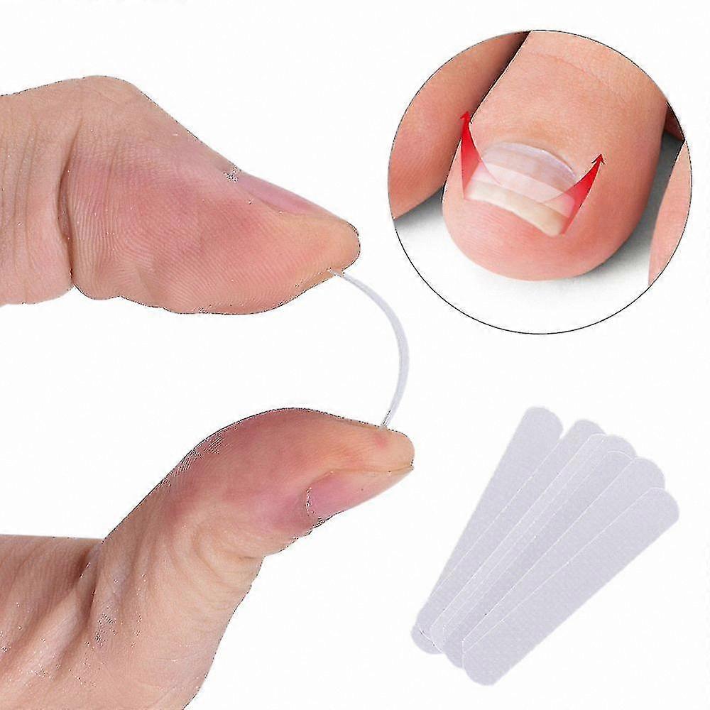 Curved Toenail Brace Set - 10pc Tool Kit for Thick Nails & Paronychia Care Solution
