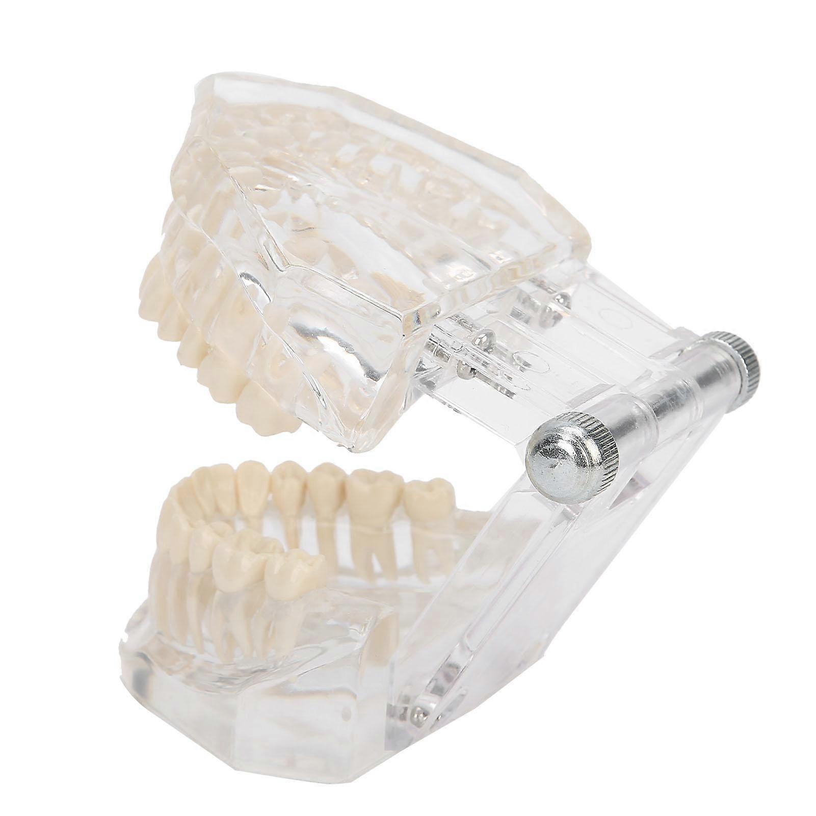 Transparent Acrylic Teeth Model Simulation Dental Teeth Model for Teaching Demonstration