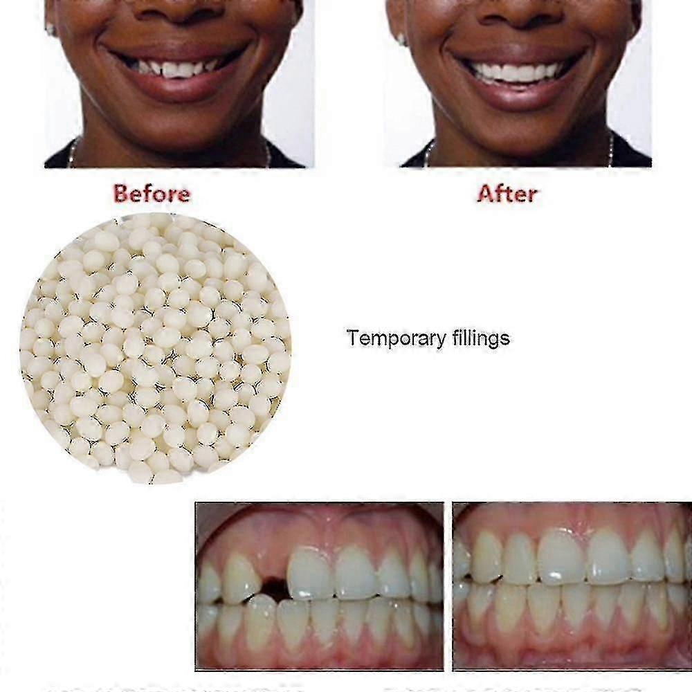 Temporary Tooth Repair, Gaps Filling Denture Adhesive False Teeth Solid Glue