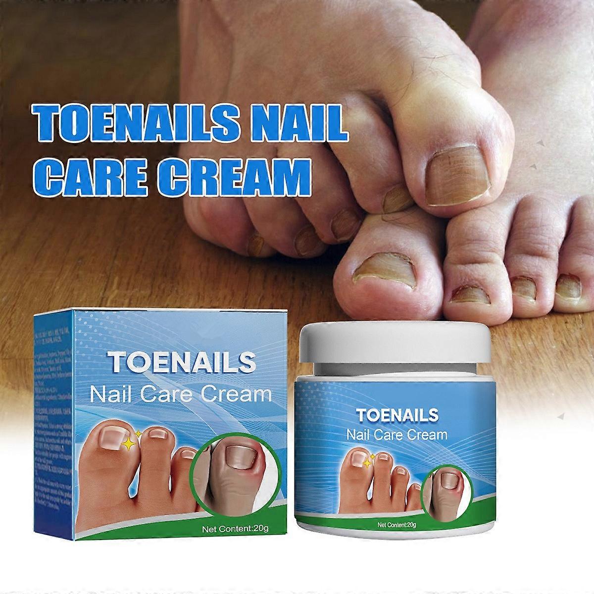 Tånagel nagelvård grädde, Tånagelsvamp behandling, Nagelsvamp vård salva, Nagelsvamp behandling för fingrar tånaglar