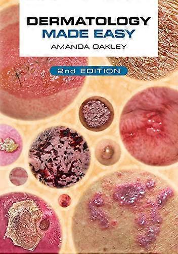 Dermatology Made Easy second edition