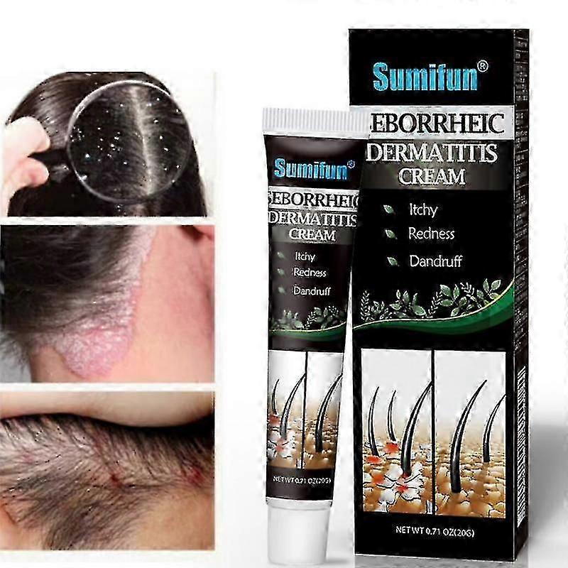 乾癬性脂漏性皮膚炎の治療法クリームヘッドにきびそう痒症頭白癬修復スキンクレンジングクリームヘアスカルプケア