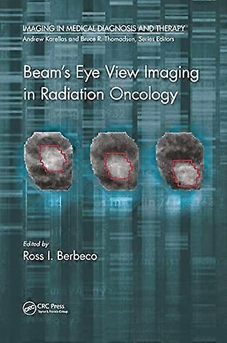 Beams Eye View Imaging in Radiation Oncology