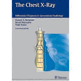 The Chest X Ray