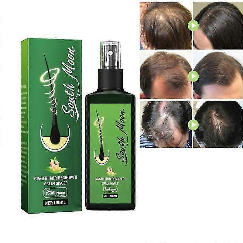 Imbir Spray na porost włosów Wzmacniający masaż włosów Skóra głowy Gęste włosy Wzmocnienie Zapobieganie wypadaniu włosów Naprawa Odżywczy płyn