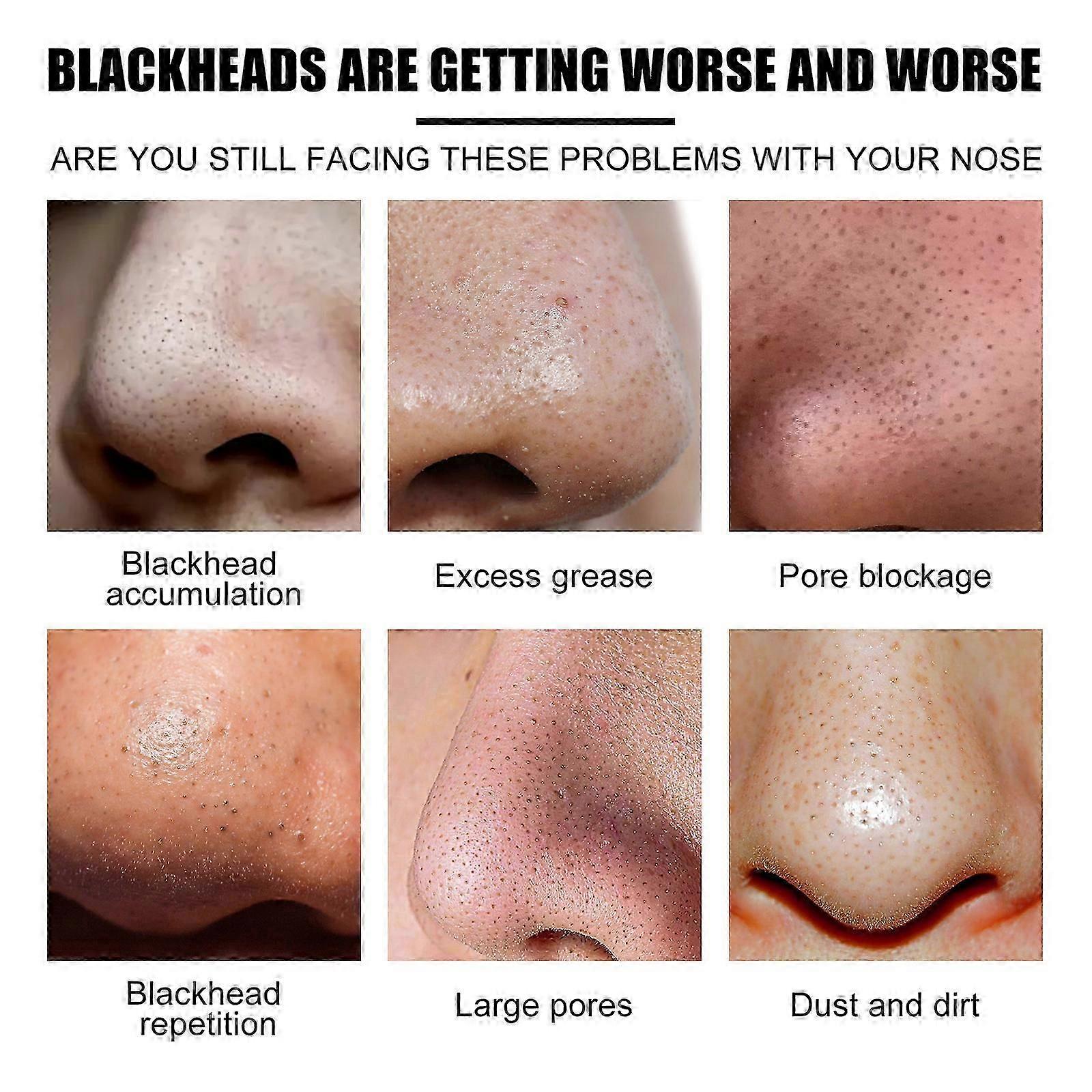 West & Month Blackhead Patch 10PCS