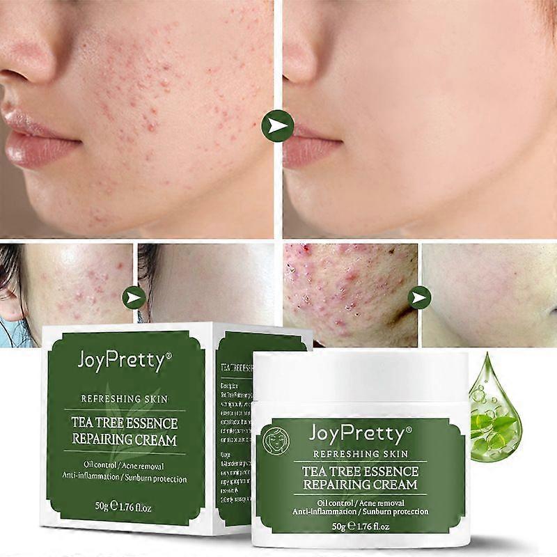 Tea Tree Acne Pimple Pits Face Cream Refreshing Moisturising Botanical Gentle Herbal Clarifying Cream