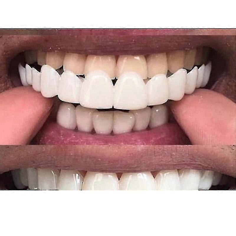 Nya Snap On Smile Dental Falska Tänder Skydd Perfect Smile Fasader Comfort Fit Flex Protes Tänder