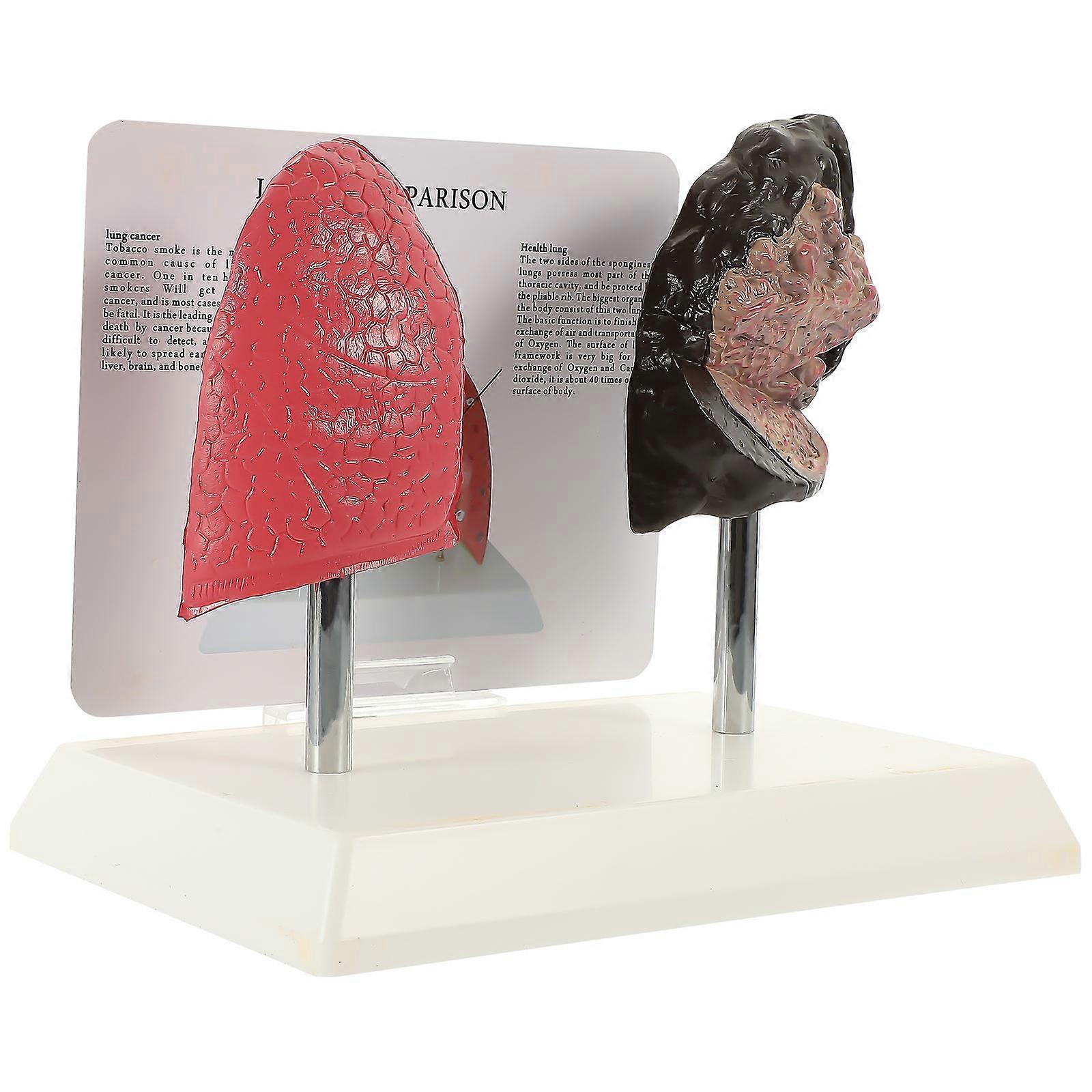 Molds Comparison Model Lung Function Demonstration Model Human Anatomical Model Anatomy Model