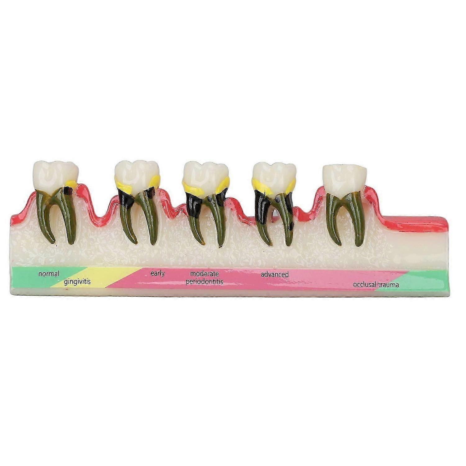 2025 Latest Model Dental Teeth Model Ceramic Clear Structure Oral Care Educati...
