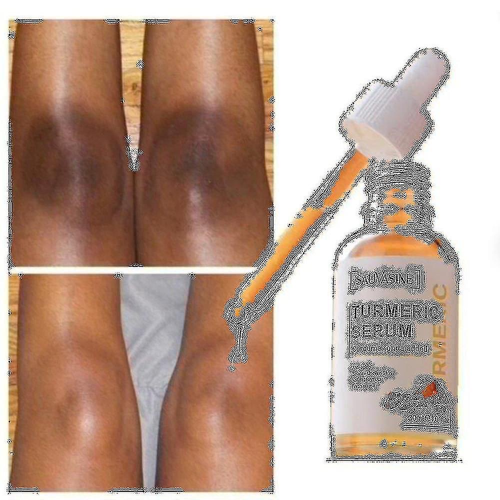 الكركم زيت الليمون البشرة توهج لتفتيح حب الشباب بقع داكنة حب الشباب البشرة الساطعة تصحيح البقع الداكنة مصحح الوجه مصل تبييض الوجه