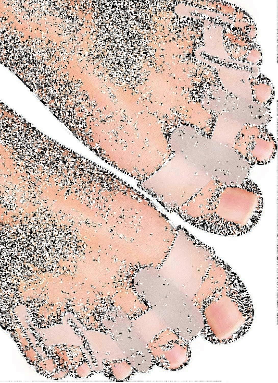 Yogamedic Toe Separator For Overlapping Toes 6pcs Improved Silicone, 0% Bpa, One-size - Bunion Corrector Toe Straightener To Relax, Spread And Stretch