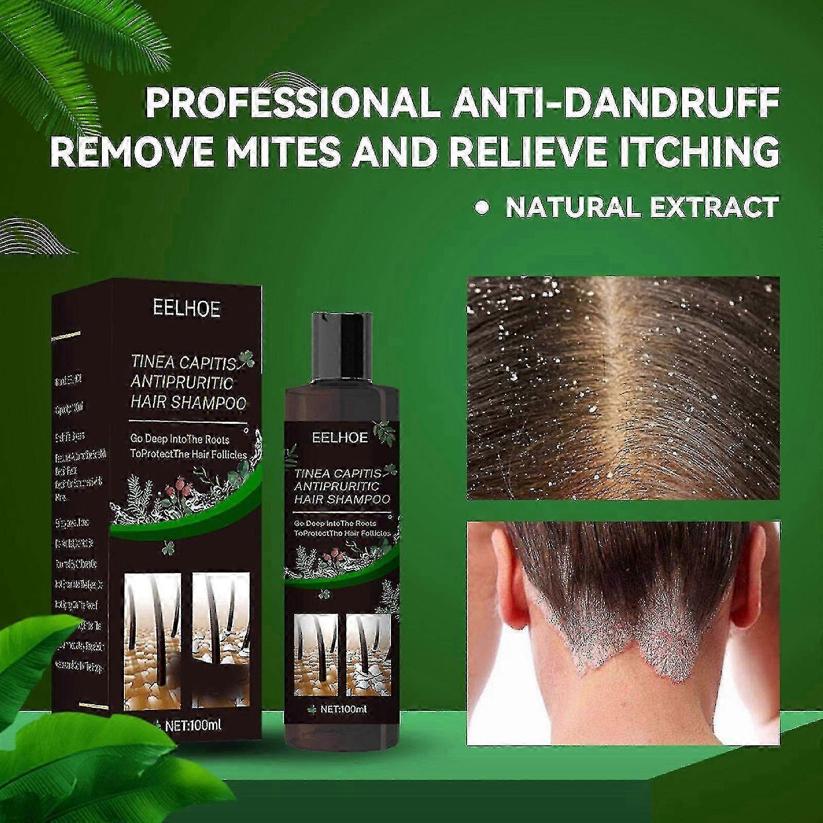 Eelhoe Tinea Capitis Itching Shampoo -8494424886173