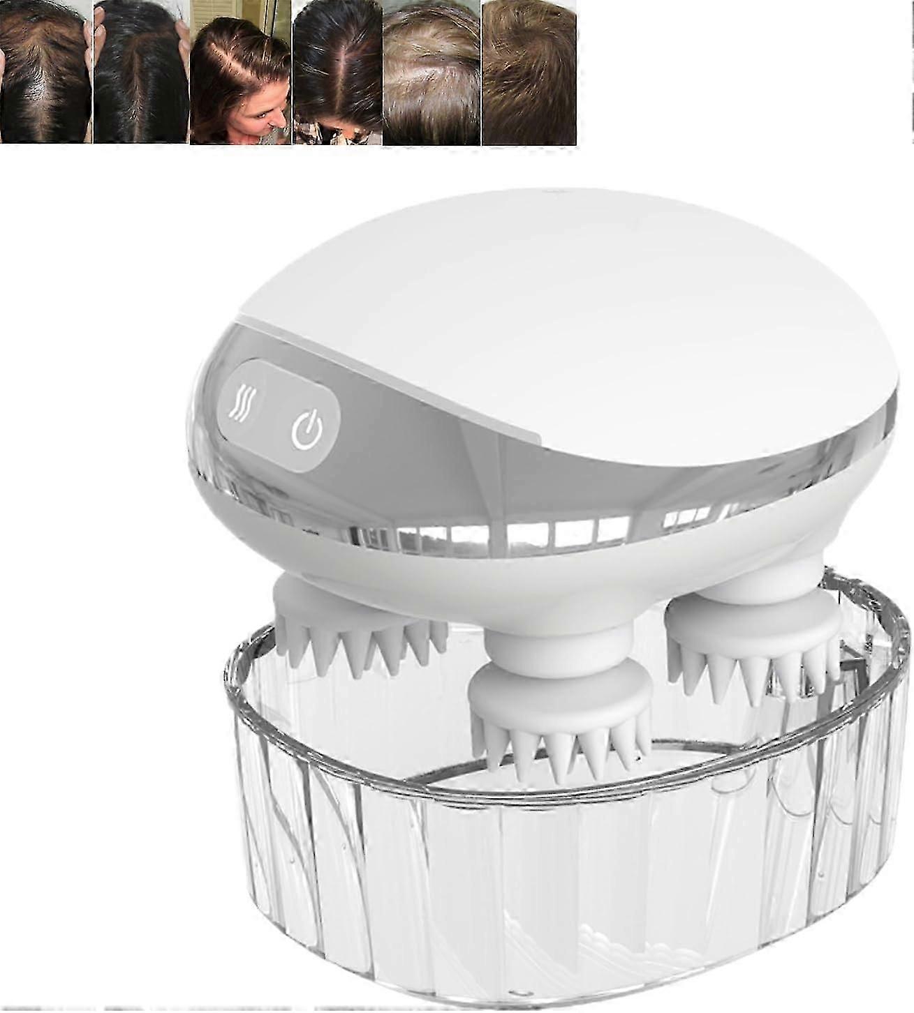 Scalphero - レッドライト付きスマートスカルプマッサージャー