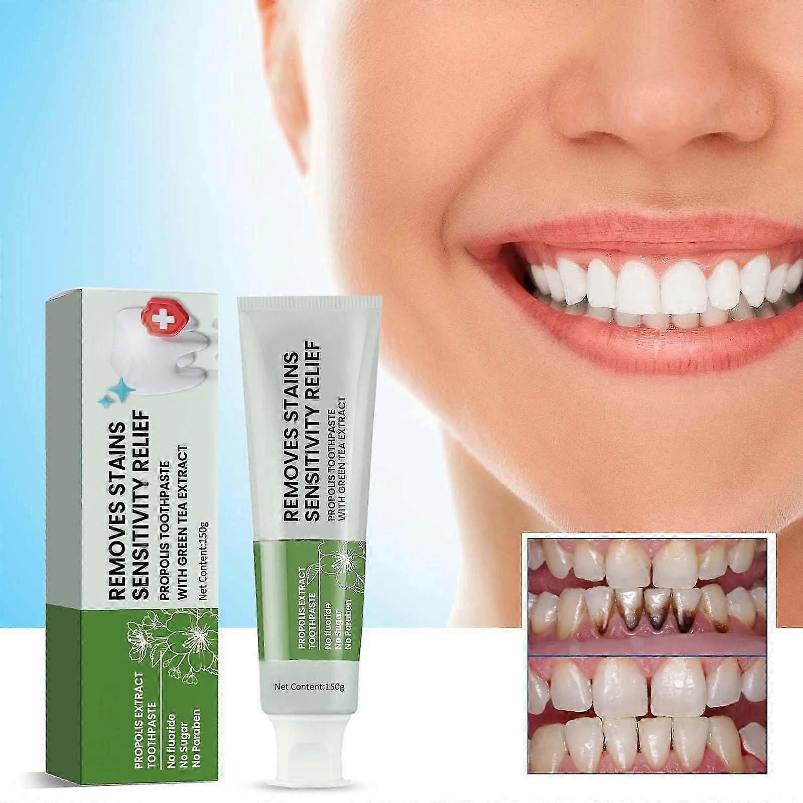 Propolis Toothpaste for Sensitive Teeth, Made with New Zealand Bee Propolis Extract, Anise, Peppermint, Eucalyptus Essential Oils Toothpaste 150g
