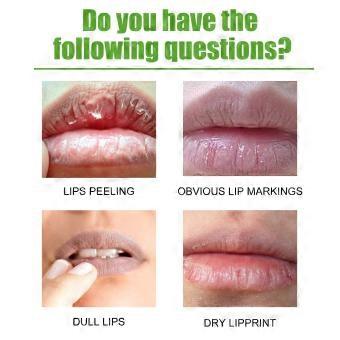 Moisturizing Aloe Vera Essence Lip Gloss Contains Mineral Oil, Mineral Wax, And White Beeswax