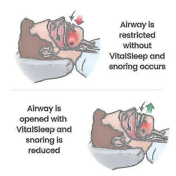 Adjustable Mouth With Silicone Anti-snoring Device--