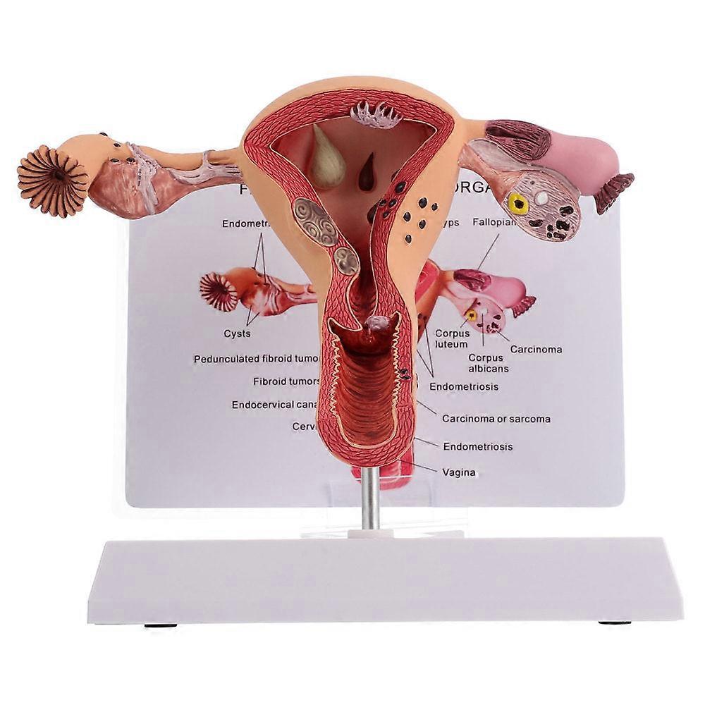 1Pc Weibliche Fortpflanzungsorgane Anatomie Modell Gebärmutter Modell Für