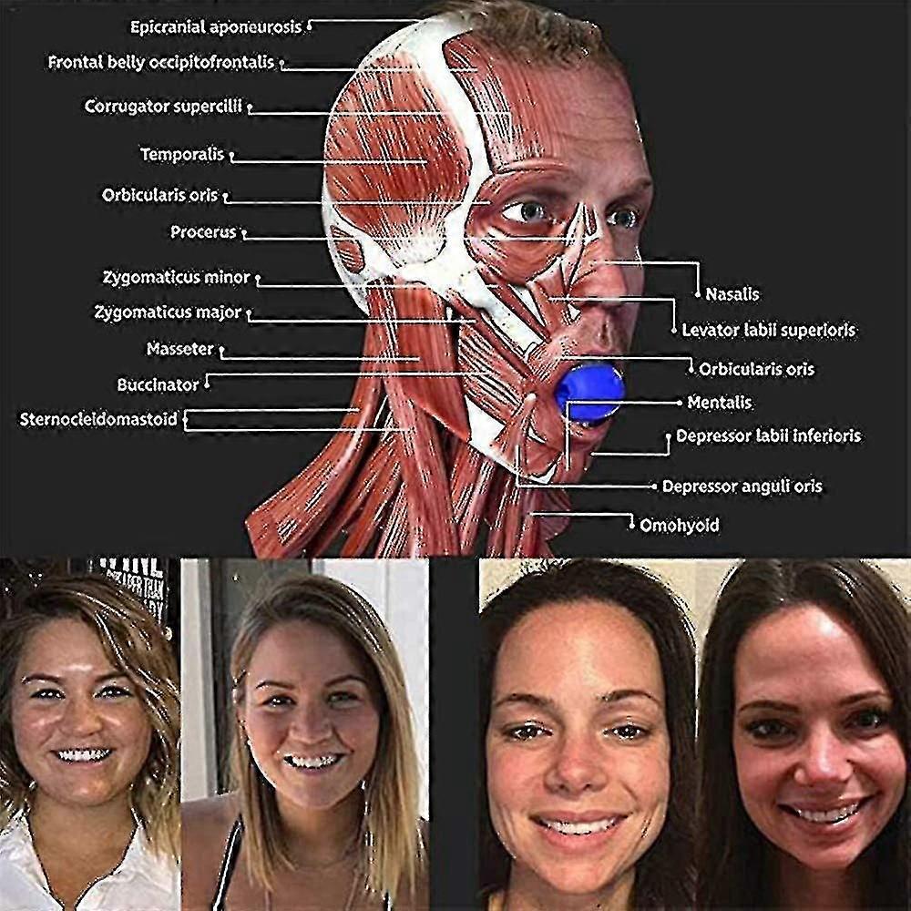 Facial Retractor, Neck/facial Jaw Trainer