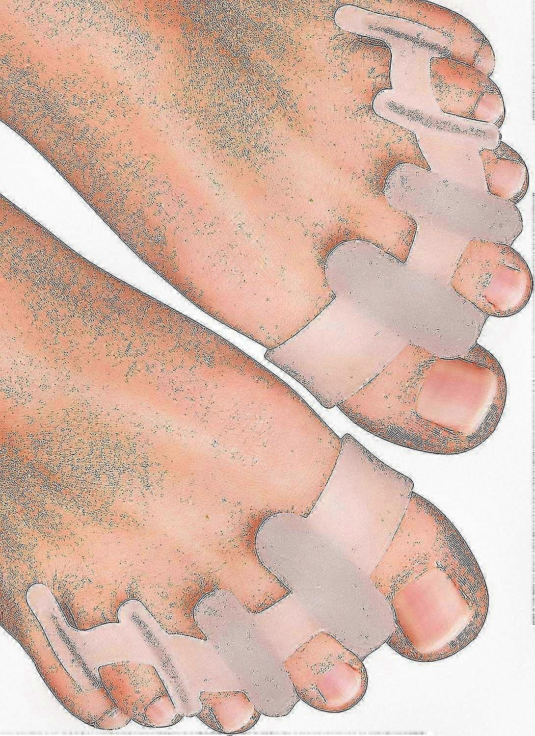 Yogamedic Silicone Toe Separators 6-Pack for Bunion Relief Overlapping Toes Alignment Comfort Stretching BPA-Free