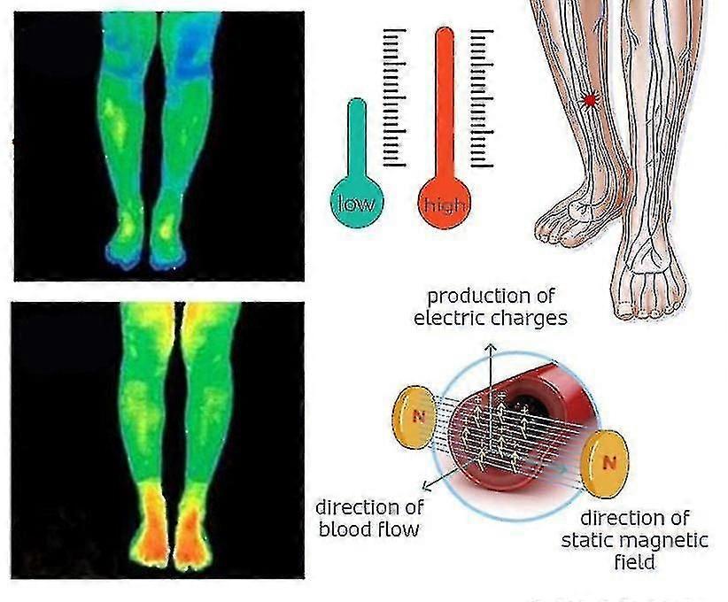 3pcs Physiotherapy Anti Ankle Edema Socks,thermal Circulation Self-heating Shaping Socks