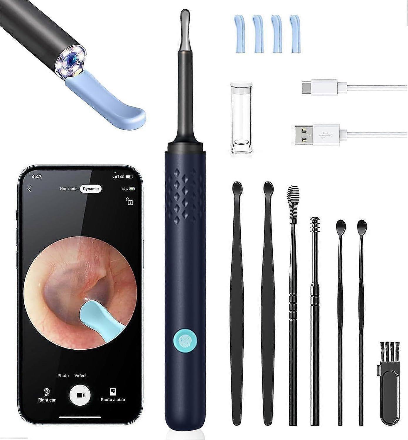 Outil d’élimination du cérumen Camera - Nettoyeur d’oreilles avec caméra, Hassle Instant enlève le cérumen, 1080