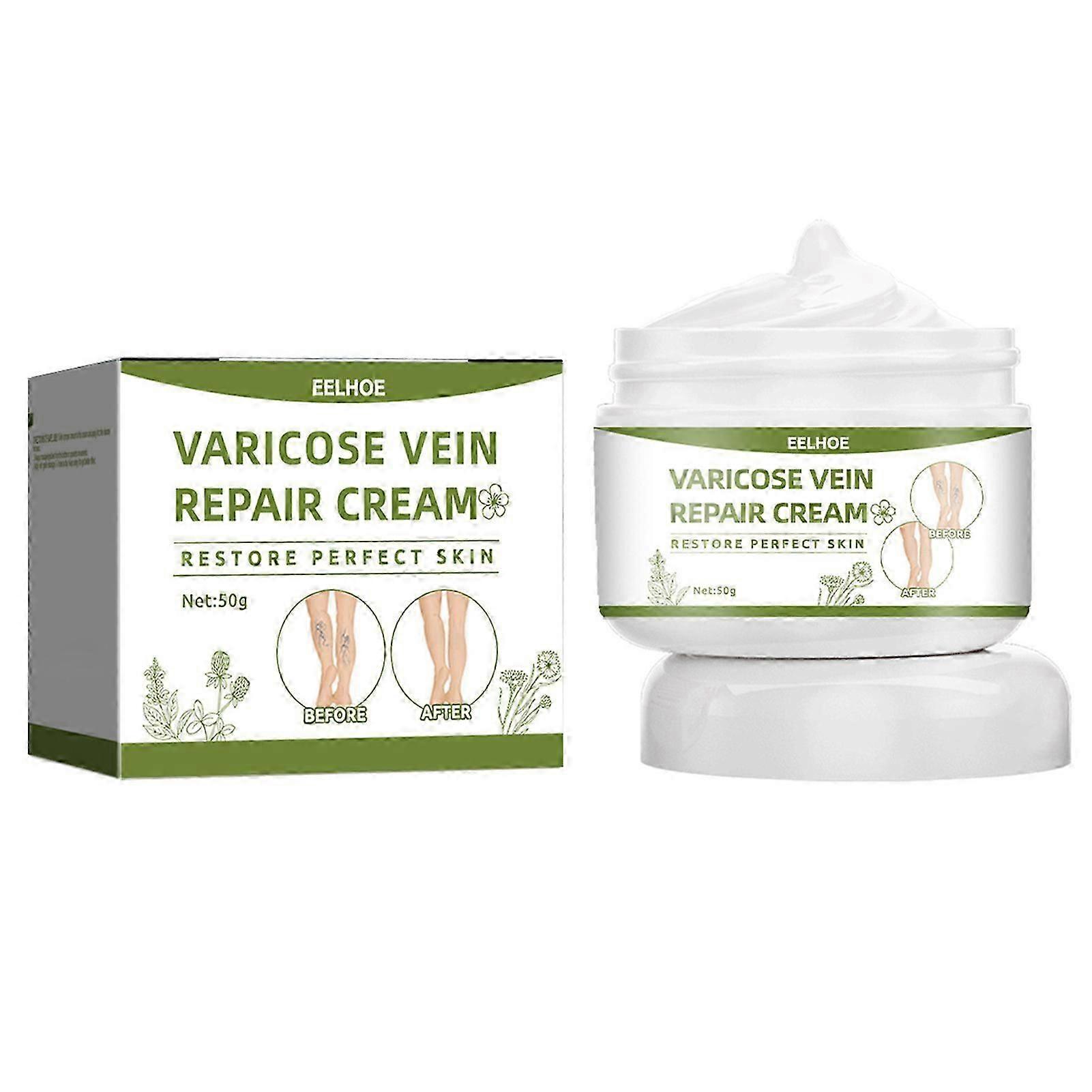 50g Varicose Veins Cream, Effective Varicose And Spider Veins Treatment_c*